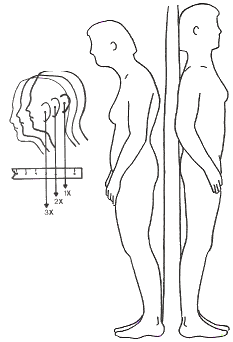 ClipArt/poor-neck-posture.gif